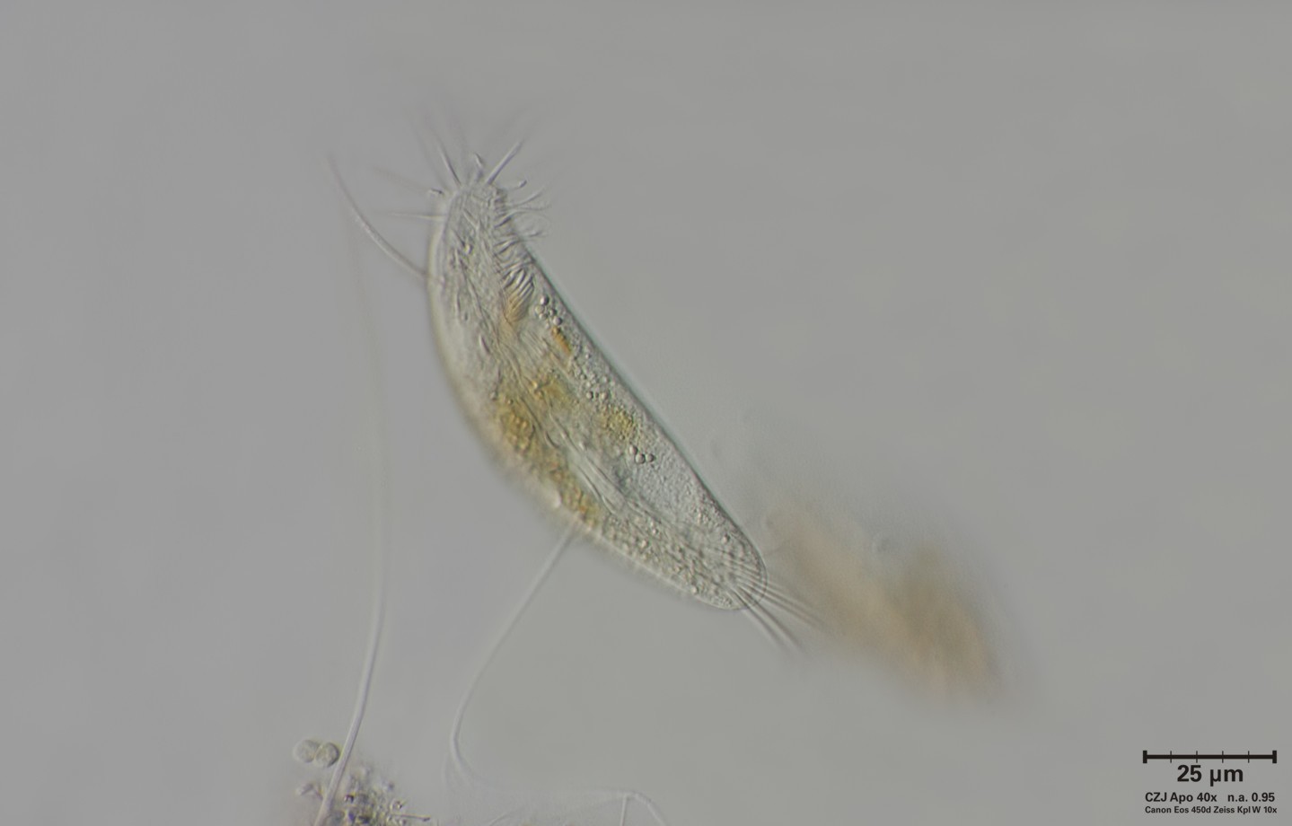 Ciliato non meglio identificato